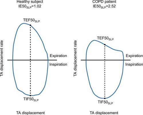 Figure 2 Illustration of how IE50SLP differed between a patient with COPD (right) and his or her age-, body mass index-, and sex-matched healthy subject (left).