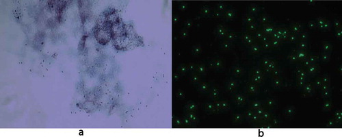 Figure 1. R. africae infected Vero-cells showing rickettsial organisms stained red with Gimenez (a) and green with immunofluorescent anti-rickettsial goat anti-rabbit immunoglobulin (b). Original magnification × 1000.