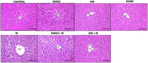 Figure 1 Hematoxylin and eosin staining of liver sections. Hepatic photomicrographs of representative rat are shown from each of the experimental groups. Magnification: 20×. CV, central vein; IR, ischemia–reperfusion; GW, animals treated with GW 4869; DMSO, group treated with dimethyl sulfoxide. Bar, 200 µm.