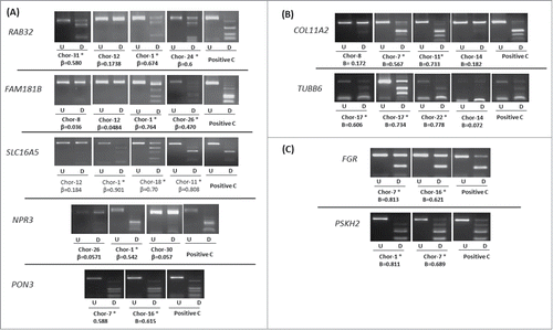 Figure 4. COBRA analysis for selected genes in chordoma samples. (A) Results of COBRA analysis for 5 genes (RAB32, FAM181B, SLC16A5, NPR3, and PON3) selected from differentially methylated gene list between recurrent and non-recurrent chordoma samples. (B) Results of COBRA analysis for 2 genes (COL11A2 and TUBB6) from differentially methylated probe list. (C) Results of COBRA analysis for 2 genes (FGR and PSKH2) selected from cancer-specific hypermethylated probe list. COBRA results are shown for chordoma samples with in vitro methylated DNA as positive control (Positive C). The digested samples (D) are loaded next to the undigested samples (U). (*) indicates methylated samples. β-value from the HumanMethylation450 BeadChip array for each selected sample is shown.