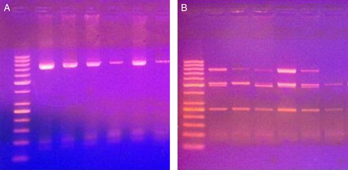 Figure 1. PCR products (A) and digestion products (B) for Asp312Asn polymorphism of 6 cases. The first lane to the left is DNA ladder (50–1000 base). Lanes 2, 4, 5, and 6 represent GA genotype. Lanes 3 and 7 represent GG genotype.