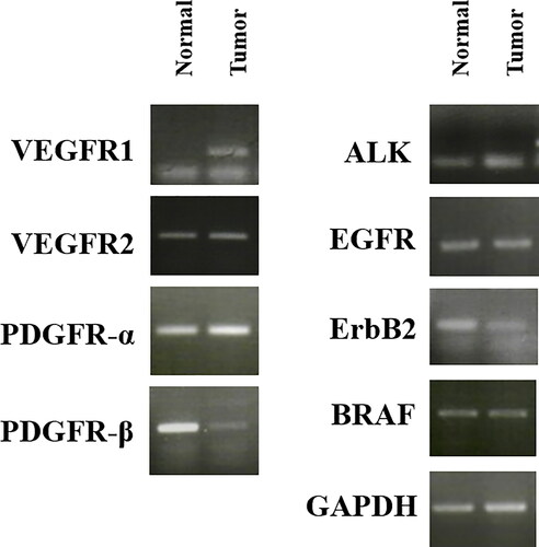 Figure 5. mRNA expression of various receptor tyrosine kinases in normal and tumor tissue samples from a dog with metastatic urethral transitional cell carcinoma. VEGFR was overexpressed in tumor compared to normal tissues. GAPDH was used for normalization. VEGFR, vascular endothelial growth factor receptor; PDGFR, platelet-derived growth factor receptors; ALK, anaplastic lymphoma kinase; EGFR, epidermal growth factor receptor.