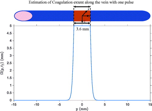Figure 6. Spatial profile of Ω(y,tf) along the vein after one pulse.  Ω(y,tf) is capped to 5 since it formally corresponds to 99 % of collagen denaturation.