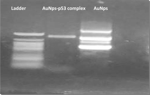 Figure 3 Gel electrophoretic analysis of the free pDNA (ladder), AuNPs.p53 complex, and free AuNPs.