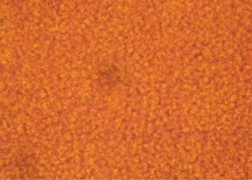 Figure 3.  Polarized light microscopy photograph of transdermal film containing sumatriptan succinate (Imigran®). System includes Azone® and an occlusive layer (original magnification × 20).