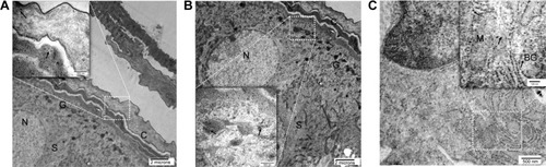 Figure 10 Transmission electron micrographs: (A) epidermal layers with magnification of stratum corneum; (B) epidermal layers with magnification of stratum granulosum (×4,800, inset: ×29,000), (C) Langerhans cell in stratum spinosum (×19,000, inset: ×72,000). Inset arrows indicate localized AgNPs. C, G, S, N, BG, and M represent stratum corneum, stratum granulosum, stratum spinosum, nucleus, Birbeck granules, and mitochondria, respectively.Abbreviation: AgNPs, silver nanoparticles.