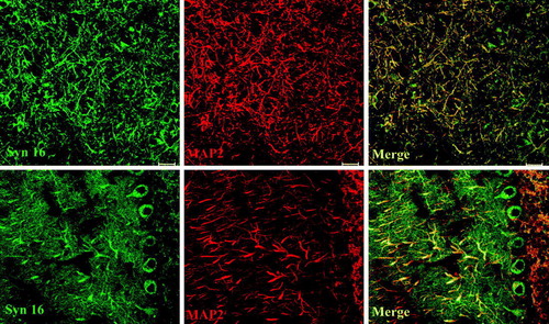 Figure 3.  Syn 16 staining is specifically concentrated in dendrites. 30 µm cryosections of adult mouse brain were double-labeled with rabbit antibody against Syn 16 (FITC, green) and mouse monoclonal antibodies against neuronal (dendritic) marker MAP-2 (Texas Red, red). The upper panel illustrates an area densely populated with dendrite. The lower panel shows part of the cerebellum where Purkinje cell bodies and its dendritic tree projection into the molecular layer. Scale bar = 20 µm.