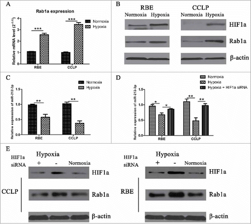 Figure 6. Hypoxia could induce expression of Rab1a through inhibiting miR-212-3p (A-B) the mRNA and protein levels of Rab1a in CCA cells were detected by RT-PCR and western blot under normoxia and hypoxia condition,***p < 0.0005.(C) the expression of miR-212-3p in CCA cells under normoxia and hypoxia condition was detected by RT-PCR,**p < 0.005.(D-E) the expression of miR-212-3p and Rab1a were compared among three different groups, including normoxia condition, hypoxia condition and hypoxia+HIF1a siRNA condition,*p < 0.05,**p < 0.005.