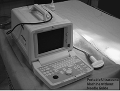 Figure 2 Portable ultrasound machine without needle guide.