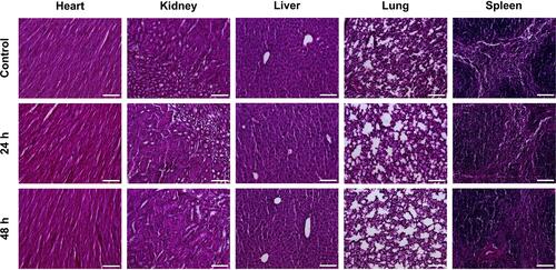 Figure 9 Histological images of main organs (heart, kidney, liver, lung, and spleen) after 24 h and 48 h of MNC injection and the untreated control group. Scale bar = 100 μm.