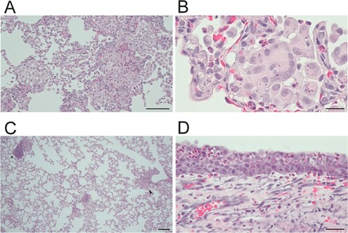 Figure 3. Histological analysis of SARS-CoV-2 infected rabbits. Histopathological analysis of rabbits inoculated with 106 TCID50, sacrificed after four days. (A) Alveolar thickening and inflammatory infiltrates. Scale indicates 100 µm (B) Enlarged, syncytial cells in the alveolar lumina. Scale indicates 20 µm. (C) Lung pathology overview. Arrow indicates thickening and asterisk bronchus-associated lymphoid tissue (BALT). Scale indicates 200 µm. (D) Eosinophilic infiltrates in the nose. Scale indicates 40 µm.