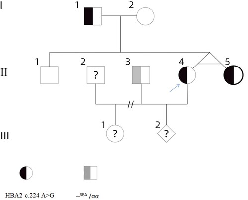 Figure 1. The family pedigree: the proband (II-4) is marked with an arrow.