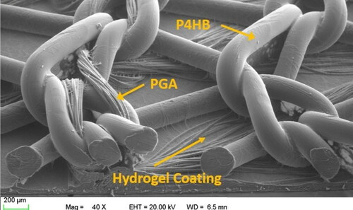 Figure 1. Scanning electron micrograph (SEM) of Phasix™ ST Mesh (40× magnification; scale bar = 200 µm). Phasix™ ST Mesh is comprised of fully resorbable poly-4-hydroxybutyrate (P4HB) fibers co-knitted with polyglycolic acid (PGA) and coated with a resorbable hydrogel layer on the visceral side of the mesh. The hydrogel layer is comprised of sodium hyaluronate (HA), carboxymethylcellulose (CMC), and polyethylene glycol (PEG).