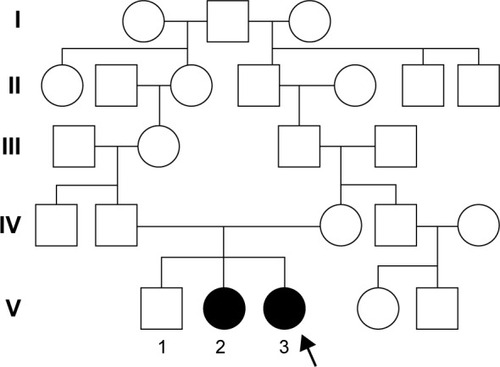 Figure 1 Extended family tree illustrating the transmission of Gitelman syndrome over five generations. Males and females are indicated by squares and circles, respectively. Affected subjects are represented by dark symbols. The index patient is V.3.