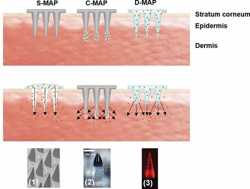 Figure 1. Illustration of vaccine microneedle array patch (MAP) types: (a) solid MAP (S-MAP), (b) coated MAP (C-MAP), (c) dissolving MAP (D-MAP). Arrows show the direction of vaccine diffusion. Representative images of S-MAP (1), C-MAP (2), and D-MAP (3)
