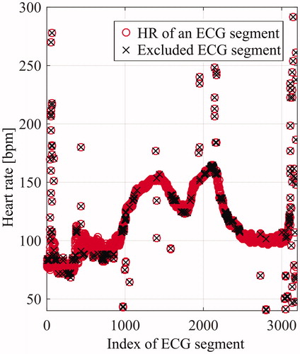 Figure 4. Heart rates (HR) of an individual during rest and workout. Motion artefacts introduce disturbances into the ECG recording that prevent correct R-peak detection. Thus, the change in HR from one beat to another is compared to the mean heart rate variability (MHRV) to indicate and exclude outliers from further processing.