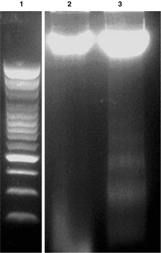 Figure 5. Chromosomal DNA of emodin-treated or -untreated MCF-7 cells following electrophoresis through a 1.5% agarose gel under UV illuminator. Lane 1: 100 bp DNA Marker; lane 2: DNA from 0.05% DMSO-treated MCF-7 cells; lane 3: DNA from 0.05% DMSO and 30 µM emodin-treated MCF-7 cells. All MCF-7 cells were treated with emodin for 72 h.