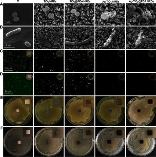 Figure 3 Antibacterial activity in vitro. (A) FE-SEM morphology of methicillin-resistant Staphylococcus aureus (MRSA) seeded on the various surfaces (scale bars =1 μm); (B) FE-SEM morphology of Escherichia coli (E. coli) seeded on the various surfaces (scale bars =2 μm); (C) fluorescent images of stained MRSA and bacterial suspension (insert in part C) after co-cultured with various surfaces for 24 hrs (scale bars =50 μm); (D) fluorescent images of stained MRSA and bacterial suspension (insert in part D) after co-cultured with various surfaces for 48 hrs (scale bars =50 μm); (E) zone of inhibition (ZOI) test of the various coatings against MRSA; (F) ZOI test of the various coatings against E. coli.