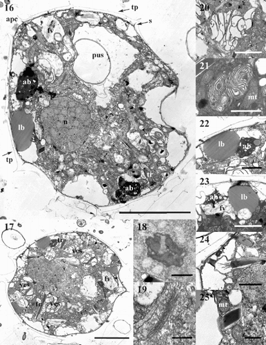 Figs 16–25. TEM micrographs of Protoperidinium vorax sp. nov. Fig. 16. Longitudinal section of the whole cell. Fig. 17. Longitudinal section of the whole cell. Fig. 18. Detail of the nucleus with the nucleolus. Fig. 19. Golgi apparatus, detail of Fig. 16. Fig. 20. Large vesicular structure with many convoluted membranes. Fig. 21. Small vesicular structure with compressed membranes. Fig. 22. Accumulation and lipid bodies, detail of Fig. 17. Fig. 23. Fibrous vesicles. Fig. 24. Longitudinal section of the terminal portion of a trichocyst, detail of Fig. 17. Fig. 25. Transverse section of a trichocyst, detail of Fig. 16. Abbreviations: (tp) thecal plate; (apc) apical pore complex; (s) thecal suture; (n) nucleus; (pus) sac pusule; (ves) vesicular structure; (ab) accumulation body; (lb) lipid body; (fv) fibrous vesicle; (tr) trichocyst; (mt) mitochondrion. Scale bars: Figs 16, 17 : 5 µm; Figs 20, 23 : 2 µm; Figs 18, 21, 22, 24 : 1 µm; Figs 19, 25 : 0.5 µm.