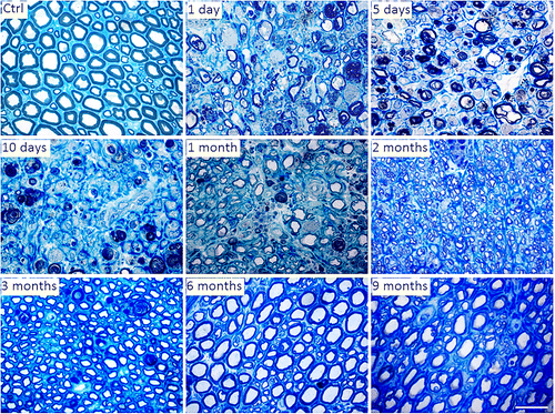 Figure 4. Representative light micrographs of toluidine blue-stained semi-thin cross sections of control and crushed median nerves at different time points in the rat animal model. Bar: 20 μm.