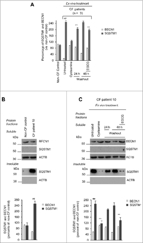 Figure 5. Effects of cysteamine and EGCG on BECN1 and SQSTM1 protein levels in ex vivo cultured primary human nasal epithelial cells belonging to the enrolled F508del-CFTR homozygous CF patients. (A and B) Effects of ex vivo treatment on BECN1 and SQSTM1 protein levels in nasal epithelial cells. (A) Mean values of BECN1 and SQSTM1 of patients No. 5, 6 and 10 of Table 1. The values are expressed as percentage of non-CF healthy control (considered as 100% of value). Mean values of 3 independent experiments for each sample; °°P < 0.01 compared to untreated, ##P < 0.01 compared to non-CF healthy control (ANOVA). (B and C) Representative blot of BECN1 and SQSTM1 protein levels in nasal epithelial cells from (B) one out of 5 non-CF control and one patient (No. 10 of Table 1) out of 3 patients analyzed and (C) patient No. 10 cultured ex vivo, as indicated. Top, western blot analysis of insoluble and soluble protein fractions and immunoblot with anti-BECN1 (Abcam) and anti-SQSTM1 (Sigma Aldrich). ACTB was used as negative marker of the insoluble protein fraction and as loading control of the experiment. Bottom, densitometric measurement of BECN1 in the soluble fraction and SQSTM1 level in the insoluble protein fraction expressed as percentage of non-CF healthy control. Mean ± SD of triplicates of independent experiments; °°P < 0.01 compared to untreated, ##P < 0.01 compared to non-CF healthy control (ANOVA).