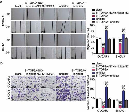 Figure 9. MiR-485-5p repressed cell migration and invasion by inhibiting TOP2A