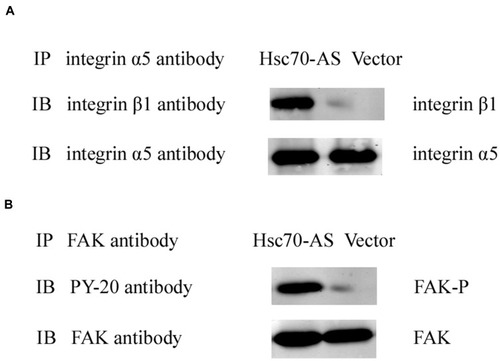 Figure 5 Reduction in the Hsc70 expression strengthened the interaction between integrin β1 and α5 subunits and increased the level of FAK phosphorylation. (A) Endogenous integrin β1 subunit interacts with integrin α5 subunit in Hsc70-AS/U87 and Vector/U87 cells. immunoprecipitation was performed with monoclonal anti-integrin α5 antibody. Co-immunoprecipitation protein was probed with indicated antibodies. (B) After incubation on FN (15 μg/mL) for 30 min, the cell lysates were immunoprecipitated by the monoclonal anti-FAK antibody. The level of FAK and phosphor-FAK was detected by indicated antibodies.