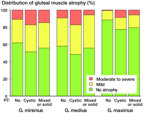 Figure 4. Distribution of grade of atrophy according to different pseudotumor (PT) findings.