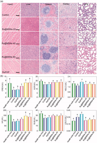 Figure 5. (a) The toxicity of the different-sized Ru@MSNs and RuPOP at 0.2 mg/kg on major organs after 21 d treatment. The scale bar is 100 μm. (b) Hematological analysis of healthy and tumor-bearing nude mice, and the treatment group of different-sized Ru@MSNs and RuPOP for 21 d. Value represents means ± SD (n = 3). 