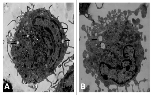 Figure 5. Transmission electron microscopy revealed BMDCs morphology, surface, cytoplasm and organelles. After cultured with NGP for 48 h, the majority of cells had a more irregular surface with more cytoplasmic projections, less vacuoles (heavy arrow) and lysosomes (thin arrow). (A) RPMI1640, (B) NGP (×5,000).