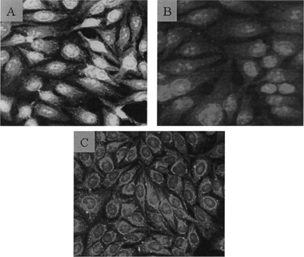 FIG. 4. Antinuclear antibodies in mouse serum. Figure A—intense staining pattern with the sera of OAA-treated mice indicates the presence of ANA. Figure B—weak staining pattern with the one ANA-positive oleic acid-treated mouse. Figure C—staining for control mouse serum.