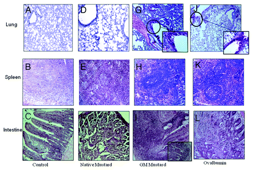 Figure 5. Histopathology of lungs, spleen and intestine of control group and sensitized mice with different proteins: (A) lung of control mice; (B) spleen of control mice; (C) intestine of control mice; (D) lung of native mustard; (E) spleen of native mustard; (F) intestine of native mustard sensitized mice; (G) lung of GM mustard; (H) spleen of GM mustard; (I) intestine of GM mustard sensitized mice; (J) lung of OVA; (K) spleen of OVA; (L) intestine of OVA sensitized mice.