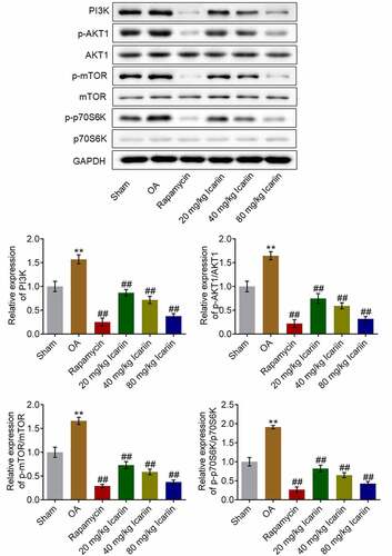 Figure 7. Icariin potently suppressed PI3K/AKT/mTOR signaling in cartilage tissues. Western blotting was used to measure the protein levels of PI3K, p-AKT1, AKT1, p-mTOR, mTOR, p70S6K, and p-p70S6K in cartilage tissues. PI3K, p-AKT1/AKT1, p-mTOR/mTOR, and p70S6K/p-p70S6K levels were significantly suppressed in the rapamycin and icariin groups (**p < 0.01 vs. Sham, ##p < 0.01 vs. OA). Data are presented as means ± SD (n = 6)