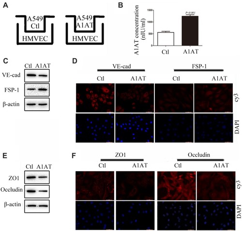 Figure 4 A1AT secreted by A549 promotes endothelial cells EndoMT. (A) A549 and HMVEC co-culture model. (B) A1AT levels in culture supernatant detected by (ELISA (P<0.01). (C, D) Analysis of the expression of VE-cadherin (endothelial marker) and FSP-1 (mesenchymal markers) in HMVECs by Western blotting (C) and immunofluorescence staining (D); scale bar, 50 μm. (E, F) Analysis of the expression of ZO1 and Occludin in HMVECs by Western blotting (E) and immunofluorescence staining (F); scale bar, 50 μm.