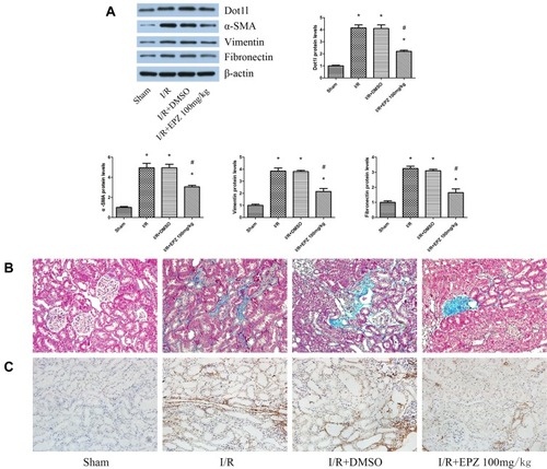 Figure 3 EPZ004777 alleviated fibrosis induced by renal I/R injury in rats.