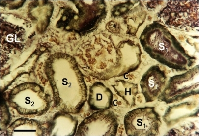 Figure 3 A freeze-dried normal kidney, vitally stained using methylene blue revealing the superficial cortex.