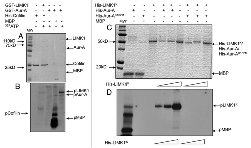 Figure 2 LIMK1 acts as a substrate of Aur-A. (A and B) Kinase assays with inactive GST-LIMK1 (500 ng) and GST-Aur-A (50 ng) kinases and His-cofilin (1 µg) or MBP (0.5 µg) as respective substrates. (A) Coomassie stained SDS-PAGE showing location of the peptide bands. MW, molecular weight marker. (B) Autoradiogram showing no phosphorylation of His-cofilin by GST-LIMK1 (lane 2), which confirms its inactivity. Strong phosphorylation of MBP and LIMK1 by Aur-A (lanes 4 and 5) and autophosphorylation of Aur-A (lane 4 and 5) could be seen. Aur-A autophosphorylation seemed to be enhanced in the presence of MBP and LIMK1. (C and D) Phosphorylation of His-LIMK1K by active His-Aur-A. (C) Coomassie stained SDS-PAGE. (D) Autoradiogram showing increased phosphorylation intensity with increasing amounts of His-LIMK1K (0.25 µg, 0.5 µg and 1 µg) by active His-Aur-A (0.22 µg) (lanes 4–6) but not by inactive His-Aur-AK162M kinase (0.22 µg) (lanes 7–9). His-Aur-AK162M was also unable to phosphorylate MBP (1 µg) (lane 2), which confirms catalytic inactivity of Aur-AK162M mutant. SDS-PAGE images are representatives of three to five independent experimental repeats.