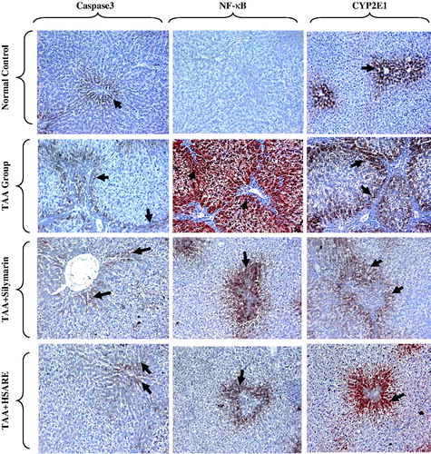 Figure 6. Immunohistochemical staining of rat liver sections for caspase-3, NF-κB and CYP2E1, showing normal control rats with few number of positive hepatocytes for caspase-3, NF-КB and CYP2E1 appearing as brownish stain (black arrows), TAA-intoxicated (100 mg/kg) rats showing few positive hepatocytes (centrilobular and periportal areas) with mild density for caspase-3, and many positive hepatocytes (centrilobular and periportal areas) with severe density for NF-κB and CYP2E1 (black arrows), and silymarin and HSARE-treated rats (50 and 100 mg/kg, respectively) showing moderate number of positive hepatocytes (periportal areas) with moderate density (periportal areas) for caspase-3 NF-κB and CYP2E1 (black arrows), (IHC, DAB, × 200).