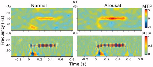 Figure 5. Spectral-temporal function of MTP and PLF in A1. (A) and (B) MTP of A1 under normal and arousal condition. (C) and (D) PLF of A1 under normal and arousal condition.