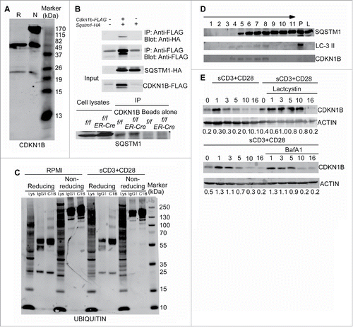 Figure 6. Autophagy selectively degrades CDKN1B in T lymphocytes. (A) CDKN1B forms polymers naturally. Cell lysates of purified T cell from wild-type mice were prepared. The cell lysates were mixed with reducing sample buffer, which contains 2-ME or nonreducing sample buffer without any 2-ME. The western blot was probed with anti-CDKN1B antibody. (B) CDKN1B interacts with SQSTM1. 293T cells were cotransfected with Sqstm1-HA and Cdkn1b-FLAG constructs. Then tagged proteins were immunoprecipitated with an anti-FLAG antibody and probed with an anti-HA antibody (upper panel). The interaction between endogenous of CDKN1B and SQSTM1 is shown in the lower panel. Atg3f/f and Atg3f/fER-Cre mice were injected with tamoxifen to delete Atg3. Splenocytes from Atg3f/f and Atg3f/fER-Cre mice were isolated and cell lysates were prepared. CDKN1B was immunoprecipitated with anti-CDKN1B antibody and probed for SQSTM1 interaction. (C) Ubiquitination of CDKN1B in splenic T cells. Splenocytes from normal mice were stimulated with soluble anti-CD3 plus anti-CD28 antibodies for 6 h. Then CDKN1B was immunoprecipitated with anti-CDKN1B mAb and the western blot membrane was probed with an anti-ubiquitin antibody. (D) CDKN1B localized in the same autophagy-related membrane structures as that of LC3-II and SQSTM1. Splenocytes from 3 normal mice were stimulated with anti-CD3 antibody in RPMI with choloroquine (50 µg/ml) for 6 h. The homogenates were prepared with protease inhibitors and choloroquine (50 µg/ml) using Dounce homogenizers. Postnuclear subcellular compartments were added into ultracentrifuge tubes on the top of prepared gradients. The distributions of target molecules in each fraction were detected by western blot in reducing condition. The arrow represents the concentration of the gradients from lower to higher densities. P, cell pellet; L, cell lysate. (E) The degradation of CDKN1B was analyzed in the presence of lactacystin or bafilomycin A1 treatment. Splenocytes from normal mice were stimulated with soluble anti-CD3 plus anti-CD28 antibodies with or without lactacystin or bafilomycin A1 treatment. The cells were collected at different time points and the T cells were purified. The expression levels of CDKN1B in T cells were analyzed by western blot.