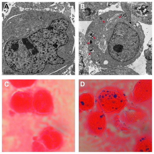 Figure 1 Distribution of nanoparticles in K562/A02 cells incubated with and without 10% (v/v) magnetic nanoparticles for 48 hours.Notes: (A) Transmission electron micrograph for control, (B) transmission electron micrograph for 10% (v/v) magnetic nanoparticles, red arrows direct nanoparticles in the endosome vesicles, and the upper left and upper right pictures were the magnifications (10×), (C) Prussian blue staining for control, and (D) Prussian blue staining for 10% (v/v) magnetic nanoparticles.