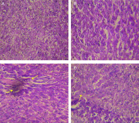Figure 7. Hematoxylin and eosin-stained sections of rat liver (40×): (A) Control rat liver: Normal architecture of liver. (B) Troxerutin (100 mg/kg) treated rat liver: normal appearance of liver cells. (C) Nickel sulfate (20 mg/kg) treated rat liver: Necrotic and degenerative changes with severe inflammatory cell infiltration were observed. (D) Nickel sulfate + troxerutin (100 mg/kg) treated rat liver: Dramatic decreases in necrotic and degenerative changes and inflammatory cell infiltration was seen Scale bar: 5 µm.