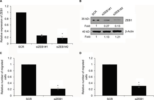 Figure 7 Overexpression of ZEB1 suppresses the migratory and invasive behavior of gastric cancer cells.