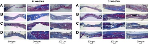 Figure 14 Histological sections (Masson’s trichrome staining) of rat cranial defect and surrounding tissue at different testing times: blank control (A), filled with NMC scaffolds (B), filled with TMC scaffolds (C), and filled with BMC scaffolds (D).Notes: Histological sections (Masson’s trichrome staining) of rat cranial defect and surrounding tissue at different testing times: blank control (A), filled with NMC scaffolds (B), filled with TMC scaffolds (C), and filled with BMC scaffolds (D). Black arrows, new bone; white arrows, host bone; black stars, scaffold materials; white star, osteoid.Abbreviations: BMC, biomimetic mineralized collagen; NMC, non-mineralized collagen; TMC, traditional mineralized collagen.