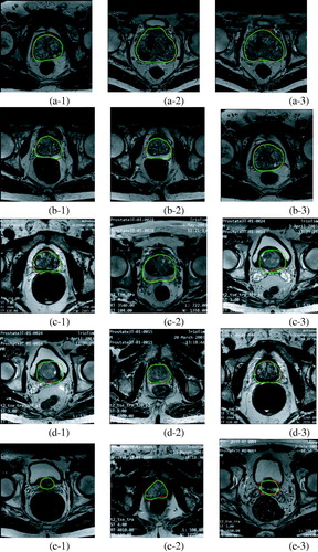 Figure 6. Segmentation results of our network on representative MR images from different patients.