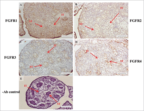 FIGURE 5. The expression patterns of FGFR1-4 at 16 d post coitum (dpc) in embryonic mice testis. The expression patterns of FGFR1 (A), FGFR2 (B), FGFR3 (C), and FGFR4 (D) at 14 dpc in mice testis were detected using immunohistochemistry. (E) represents control section without a primary antibody. The long arrow indicates the cell types as illustrated by the abbreviations: ST, seminiferous tubules and IT, interstitial region. Scale bar = 100 µm (200 ×).