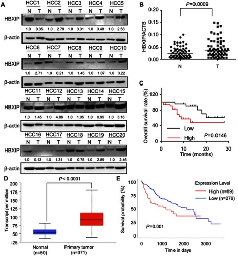 Figure 1 HBXIP is upregulated in HCC and predicts poor prognosis of patients with HCC. (A)The HBXIP protein levels in 20 pairs of HCC tumor (T) and correspondence nontumor (N) tissues were examined by western blot. The gray value of these western blot was normalized to nontumor. (B)The HBXIP mRNA levels in 61 pairs of HCC tumor (T) and correspondence nontumor (N) tissues were examined by qRT-PCR (paired student’s t-test). The lines represent the median value of the HBXIP expression in tumor and corresponding nontumor tissue, respectively. (C) Kaplan–Meier analysis of overall survival based on HBXIP mRNA expression levels in 61 cases of HCC patients. Survival curves were calculated using Kaplan–Meier and log-rank tests. The median level of HBXIP mRNA in HCC tissues is used as the cutoff. Patients with HCC were divided into high-level group (whose expression is higher than the median) and low-level group (whose expression is lower than the median). (D) HBXIP mRNA expression in normal and HCC tissues from TCGA datasets. Data are mean ± SD. (E) Kaplan–Meier survival analysis of the whole HCC patients according to HBXIP mRNA expression. High level indicated expression value >3rd quartile, while low level indicated expression value<3rd quartile.Abbreviations: HCC, hepatocellular carcinoma; HBXIP, hepatitis B virus X-interacting protein.