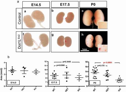 Figure 3. Targeted disruption of Dot1L H3K79 methyltransferase activity in Six2+ nephron progenitors impairs renal growth. (a) Gross morphology views showing that homozygous disruption of Dot1L (Dot1LSix2) causes small kidneys with petechial surface lesions. (b) Surface area analysis (see methods) of control and Dot1LSix2 kidneys during development. Targeted disruption of one allele of Dot1L in nephron progenitors did not affect renal size during maturation; however, disruption of both Dot1L alleles caused a marked reduction in renal size