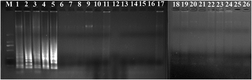 Figure 2. Specificity of PSR assay for detection L. monocytogenes strains with hylA genes by 1.5% agarose gel electrophoresis; M-DNA marker; lane 1–5, L. monocytogenes ATCC19116, ATCC19114, ATCC19115, ATCC15313, ATCC19113; lane/tube 6–25, non-L. monocytogenes strains of Escherichia coli O157:H7 (ATCC43894, ATCC43895, E019, E020, E043, E044), Salmonella enteric (ATCC29629, ATCC14028, ATCC19585, ATCC13076), Vibrio parahaemolyticus (ATCC27969, ATCC17802), Pseudomonas aeruginosa (ATCC27853, C9, C40), Staphylococcus aureus (ATCC23235, ATCC25923, 10085, 10071), and Lactobacillus casei; lane 26, negative control.