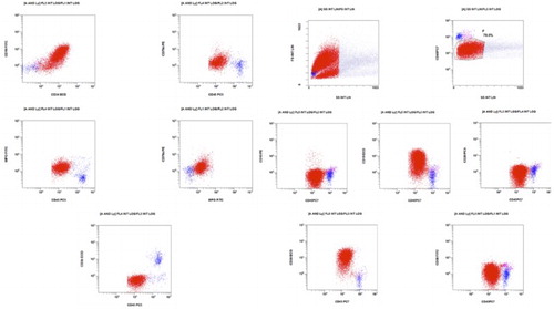 Figure 2 The abundant malignant cells (red) display basically the same phenotype as that at the home of diagnosis, although the former dim expression of CD20 is now absent. Co-expression of CD79a and MPO remains unchanged.